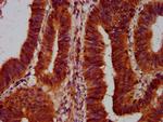 SLC5A5 Antibody in Immunohistochemistry (Paraffin) (IHC (P))