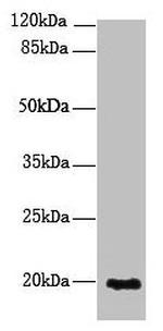 NUDT11 Antibody in Western Blot (WB)