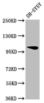 VPS39 Antibody in Western Blot (WB)