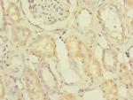 PDCL2 Antibody in Immunohistochemistry (Paraffin) (IHC (P))