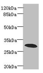 PDCL2 Antibody in Western Blot (WB)