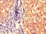 BBS1 Antibody in Immunohistochemistry (Paraffin) (IHC (P))