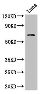 BBS1 Antibody in Western Blot (WB)