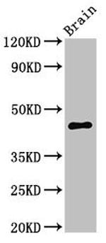 UHMK1 Antibody in Western Blot (WB)