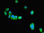 PNPLA1 Antibody in Immunocytochemistry (ICC/IF)