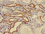 ATP6V0A1 Antibody in Immunohistochemistry (Paraffin) (IHC (P))