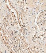 Ubiquitin Antibody in Immunohistochemistry (Paraffin) (IHC (P))