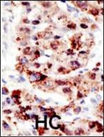 Ubiquitin Antibody in Immunohistochemistry (Paraffin) (IHC (P))