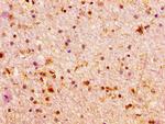 ARX Antibody in Immunohistochemistry (Paraffin) (IHC (P))