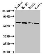 ARX Antibody in Western Blot (WB)