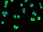 UNC80 Antibody in Immunocytochemistry (ICC/IF)