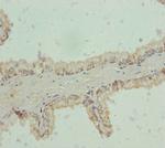 RNF34 Antibody in Immunohistochemistry (Paraffin) (IHC (P))