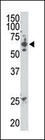 SENP2 Antibody in Western Blot (WB)