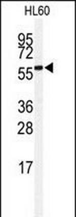 SENP2 Antibody in Western Blot (WB)