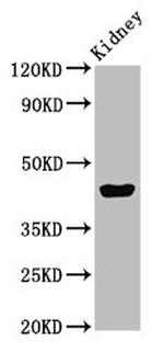 EAF2 Antibody in Western Blot (WB)