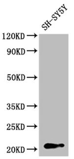 GNPNAT1 Antibody in Western Blot (WB)