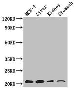 GNPNAT1 Antibody in Western Blot (WB)