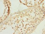 PPP3R2 Antibody in Immunohistochemistry (Paraffin) (IHC (P))