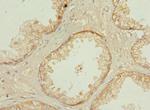 PPP3R2 Antibody in Immunohistochemistry (Paraffin) (IHC (P))