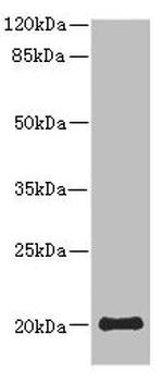 PPP3R2 Antibody in Western Blot (WB)