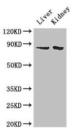 SMO Antibody in Western Blot (WB)