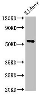 FUCA1 Antibody in Western Blot (WB)