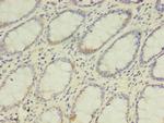 DPH2 Antibody in Immunohistochemistry (Paraffin) (IHC (P))