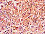 TNRC6C Antibody in Immunohistochemistry (Paraffin) (IHC (P))