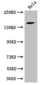 TNRC6C Antibody in Western Blot (WB)