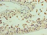 AASDHPPT Antibody in Immunohistochemistry (Paraffin) (IHC (P))