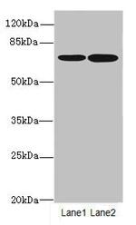 SLC23A2 Antibody in Western Blot (WB)