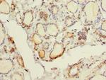 FYCO1 Antibody in Immunohistochemistry (Paraffin) (IHC (P))