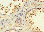 RSPH9 Antibody in Immunohistochemistry (Paraffin) (IHC (P))