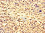 RSPH9 Antibody in Immunohistochemistry (Paraffin) (IHC (P))