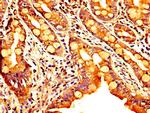 SEMA4B Antibody in Immunohistochemistry (Paraffin) (IHC (P))