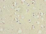 MTCH1 Antibody in Immunohistochemistry (Paraffin) (IHC (P))