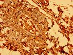 SEMA5B Antibody in Immunohistochemistry (Paraffin) (IHC (P))