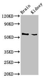 SLC25A23 Antibody in Western Blot (WB)