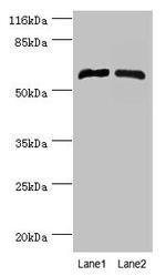 CYP4F11 Antibody in Western Blot (WB)