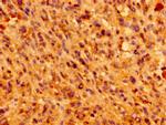 IFT46 Antibody in Immunohistochemistry (Paraffin) (IHC (P))