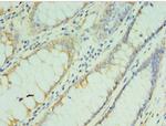 TMOD3 Antibody in Immunohistochemistry (Paraffin) (IHC (P))