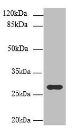 UTP23 Antibody in Western Blot (WB)