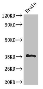 NPL Antibody in Western Blot (WB)