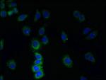 TMEM38B Antibody in Immunocytochemistry (ICC/IF)