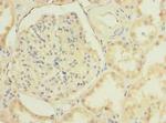 TMEM38B Antibody in Immunohistochemistry (Paraffin) (IHC (P))