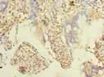 TMEM38B Antibody in Immunohistochemistry (Paraffin) (IHC (P))