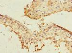 PLK3 Antibody in Immunohistochemistry (Paraffin) (IHC (P))