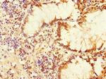 PLK3 Antibody in Immunohistochemistry (Paraffin) (IHC (P))