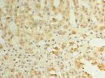 ZDHC3 Antibody in Immunohistochemistry (Paraffin) (IHC (P))