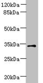 ZDHC3 Antibody in Western Blot (WB)